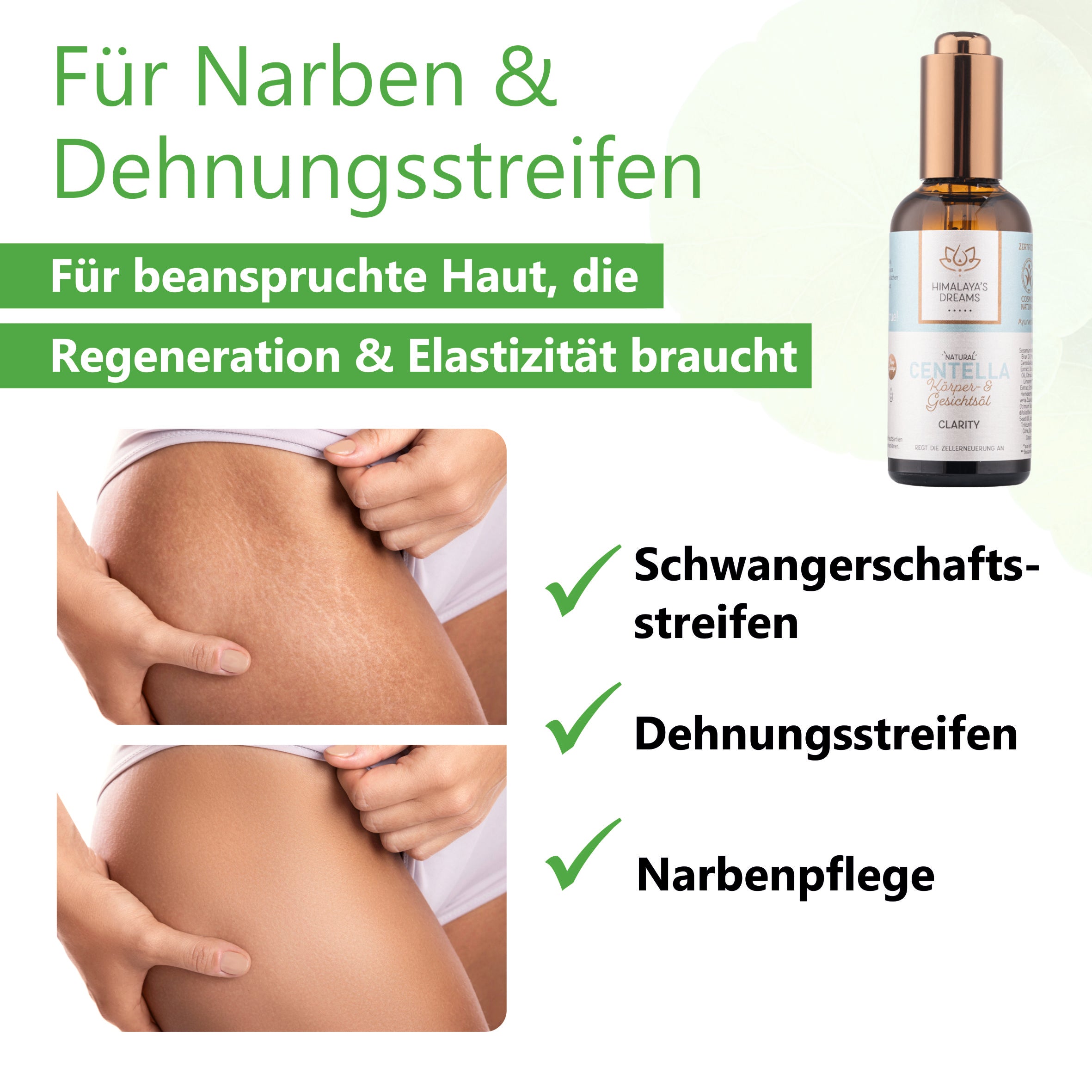 Ayurveda Körper- und Gesichtsöl Centella/Clarity 100ml / Bei Narben & Dehnungsstreifen