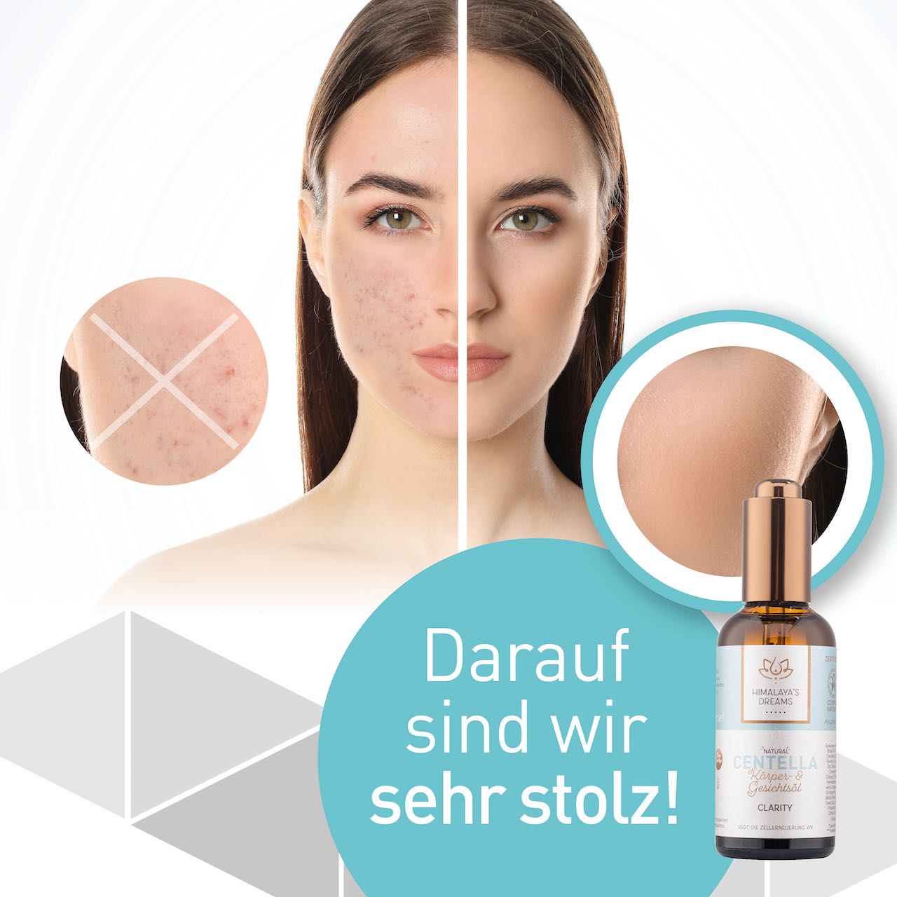 Ayurveda Körper- und Gesichtsöl Centella/Clarity 100ml / Bei Narben & Dehnungsstreifen