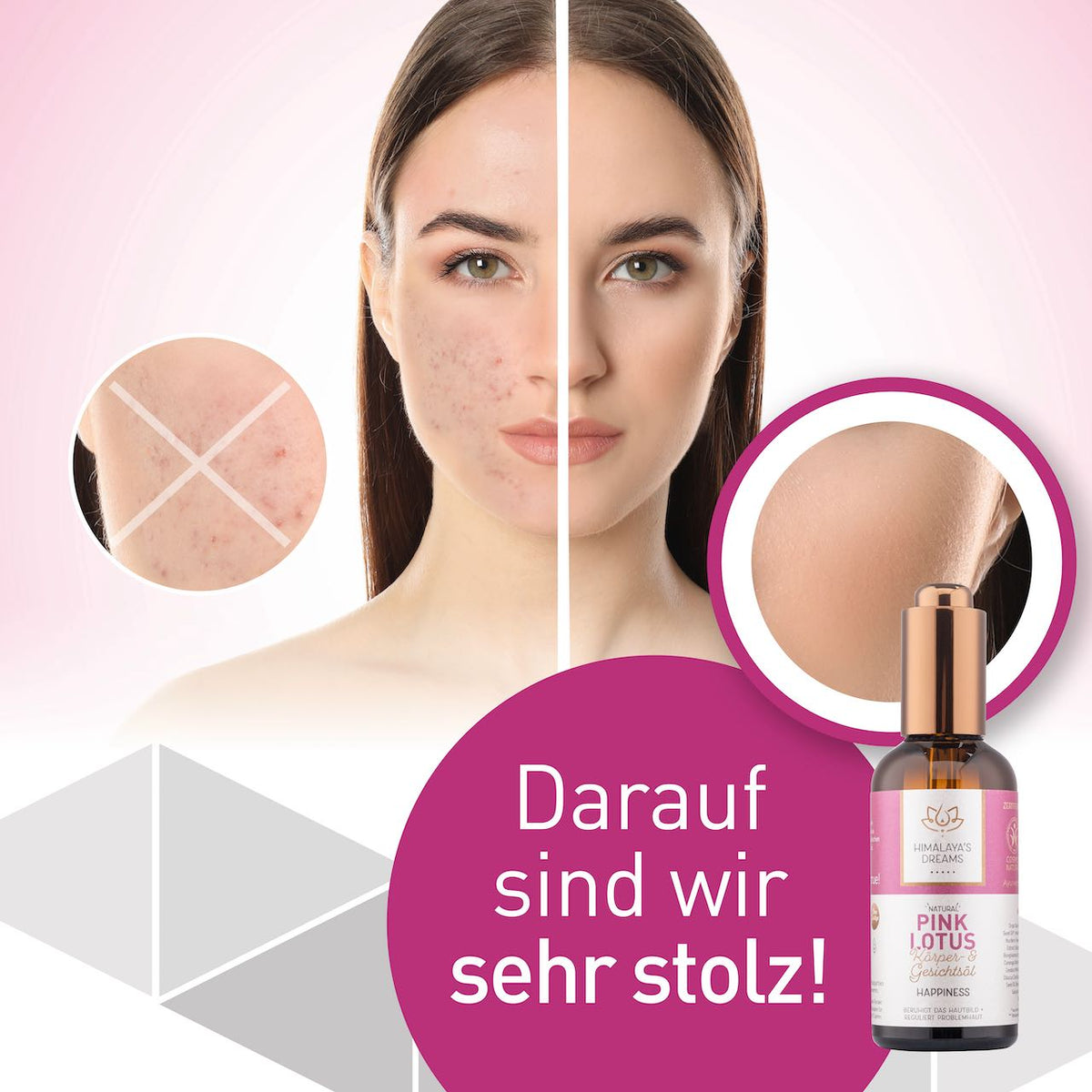 Ayurveda Body and Face Oil Pink Lotus/Happiness 100ml himalayasdreams