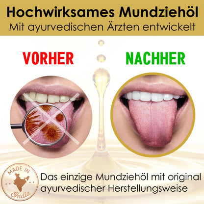 Ayurveda Ziehgold BALANCE 250ml mit sehr hohem BIO-Kokosöl Gehalt und vielen Gewüzen für ein noch effektiveres Ergebnis