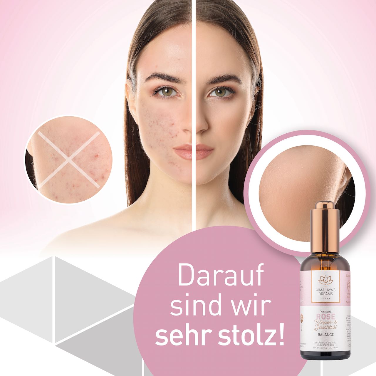 Ayurveda Körper- und Gesichtsöl Rose / Balance 100ml / Bei geröteter & empfindlicher Haut