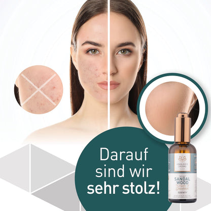 Ayurveda Körper- und Gesichtsöl Sandelholz/Serenity 100ml / Bei sehr rauer Haut & Sonnenbrand